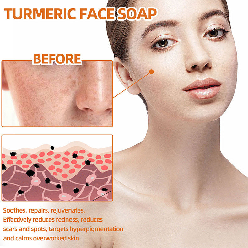 Turmeric Face Soap Facial Repair Gentle Cleansing Mite Removal Spot Fine Lines