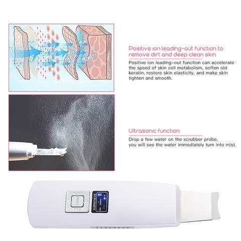 Ultrasonic Skin Scrubber: Face Cleanser for Blackhead and Acne Removal Experience a facial spa treatment  vibrating massager, featuring ultrasound peeling technology for effective cleansing. Model 394.