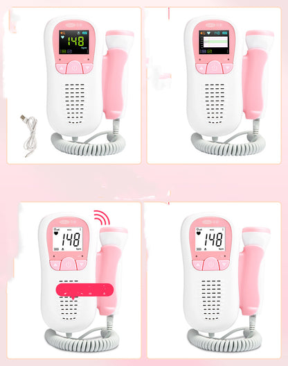 Corfu Doppler Fetal Favorite