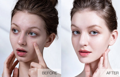 Plant Extract Warm And Moisturizing Herbal Acne Cream