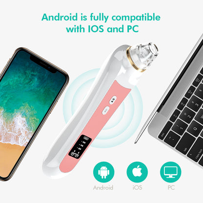 High definition visual electric blackhead absorber