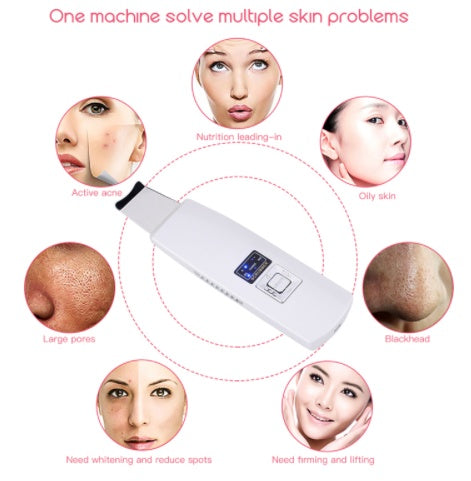 Ultrasonic Skin Scrubber: Face Cleanser for Blackhead and Acne Removal Experience a facial spa treatment  vibrating massager, featuring ultrasound peeling technology for effective cleansing. Model 394.