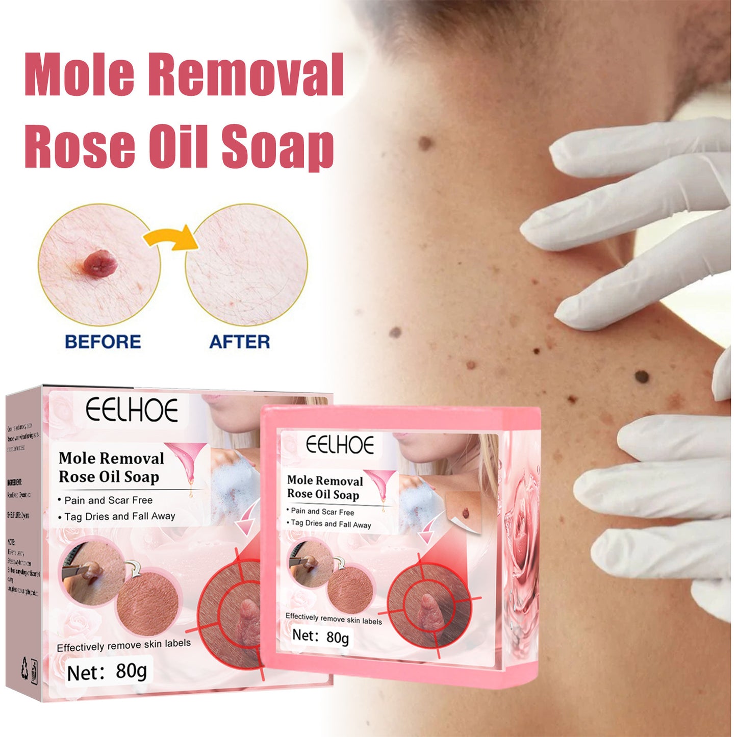 Cure Warts Remove Moles Face And Neck Filamentous Warts Body Cleaning Soap