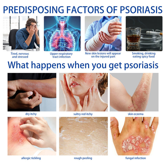 Care To Relieve Skin Discomfort Nourishing Moisturizing Daily Massage Care Cream