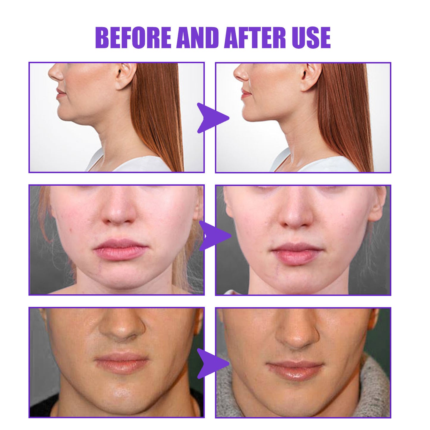 Tighten The Contour Lift And Tighten The Chin Face Skin Sagging Massage Cream