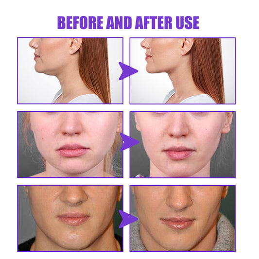 Tighten The Contour Lift And Tighten The Chin Face Skin Sagging Massage Cream