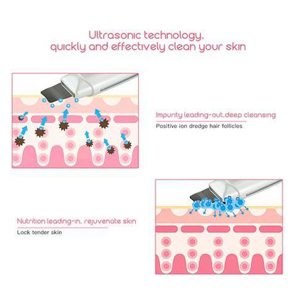Ultrasonic Skin Scrubber: Face Cleanser for Blackhead and Acne Removal Experience a facial spa treatment  vibrating massager, featuring ultrasound peeling technology for effective cleansing. Model 394.