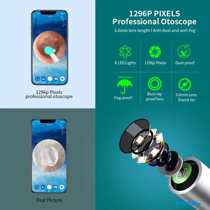 Home Use Portable Wifi Otoscope Camera Ear Wax Remover Intelligent Electric Visual Ear Cleaner Ear Wax Cleaner