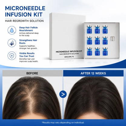 Microneedle Hair Regrowth Kit Solution Scalp Nourishing Serum For Hair Health Maintenance Needle Head Use Scalp Care Kit