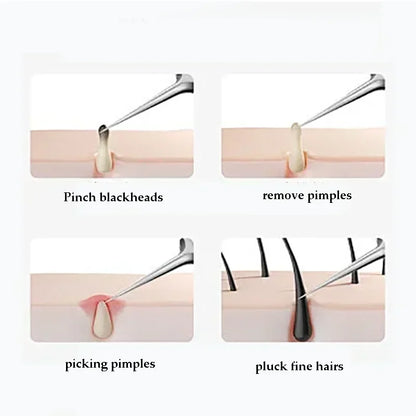 4-11Pcs Ingrown Hair Tweezers Acne Blackhead Removal Needles Black Dots Cleaner Deep Cleansing Pore Cleaner Face Skin Care Tools