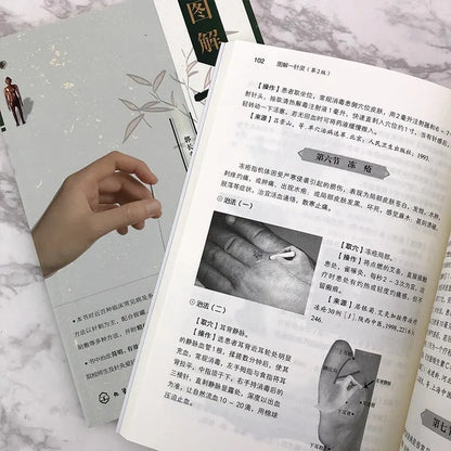 Acupuncture Points Book for Quick Pain Relief - Essential Guide to Effective Single Point Therapy
