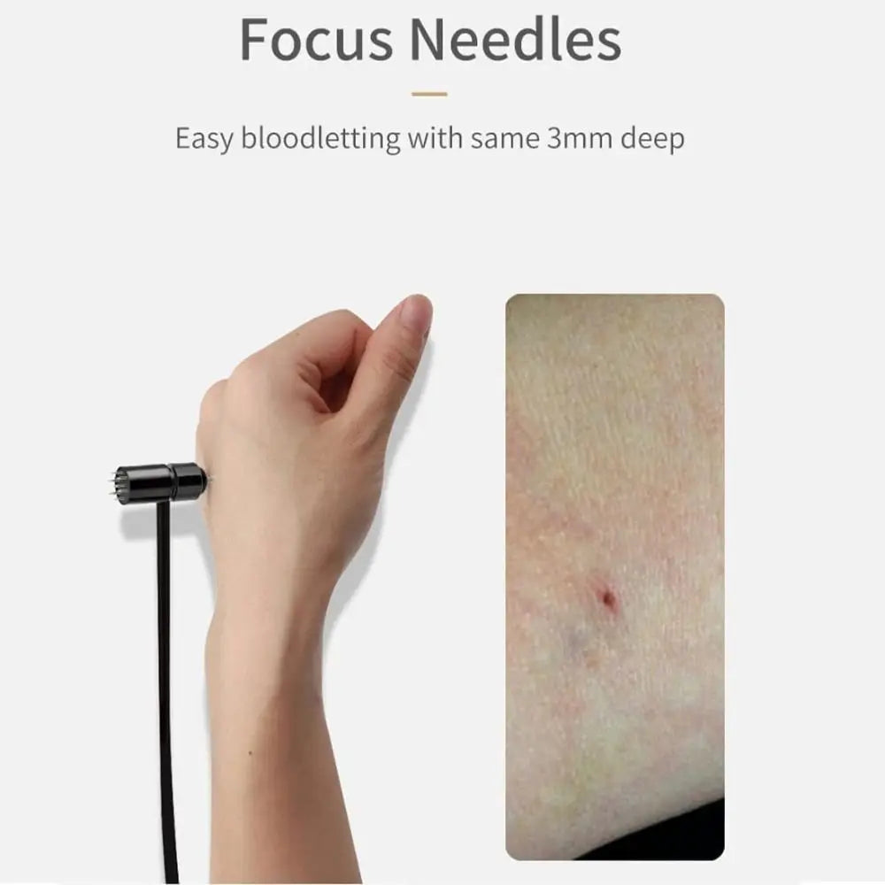 New Plastic 7 Star Needle Single Head Double Head Plum Blossom Dermal Hammer Portable Needle Massage for Home Use