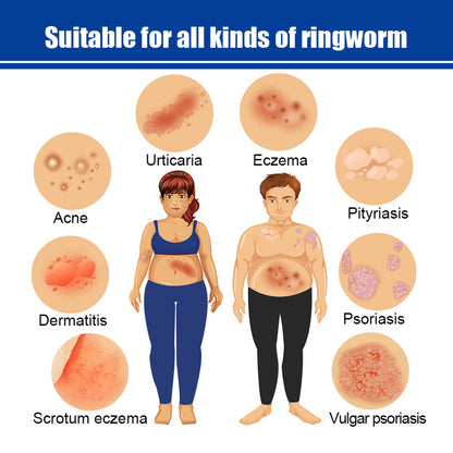 Care To Relieve Skin Discomfort Nourishing Moisturizing Daily Massage Care Cream