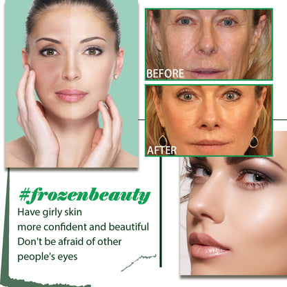 Moisturizing Lifting Fading Wrinkle French Lines Facial Skin The Lifting Face Serum