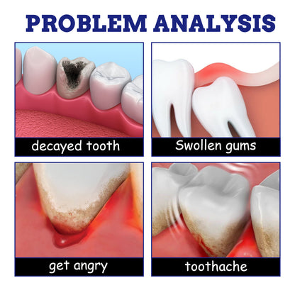 Simple And Creative Gum Swelling Pain Spray
